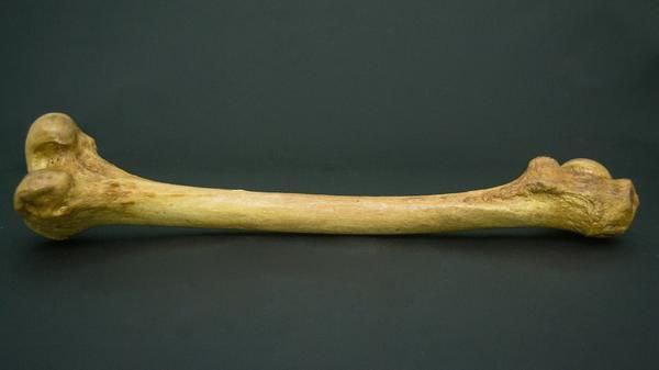 一根愈合的大腿骨1980年，美国医生保罗·布兰德（Paul Brand）在《可怕而奇妙的创造》书中回忆了米德的一次讲座